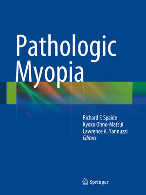 cover image of Pathologic Myopia